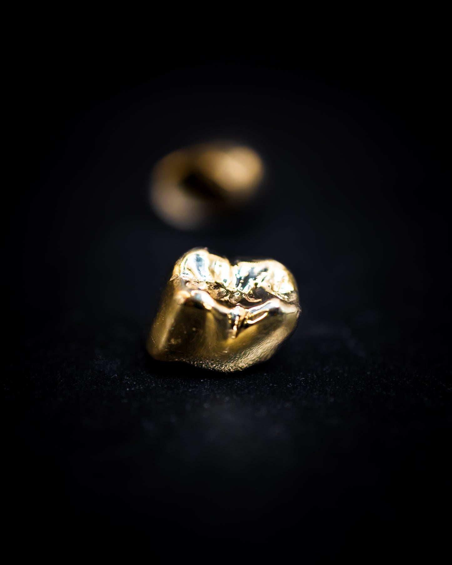 Gold Crown (Additional charges apply)