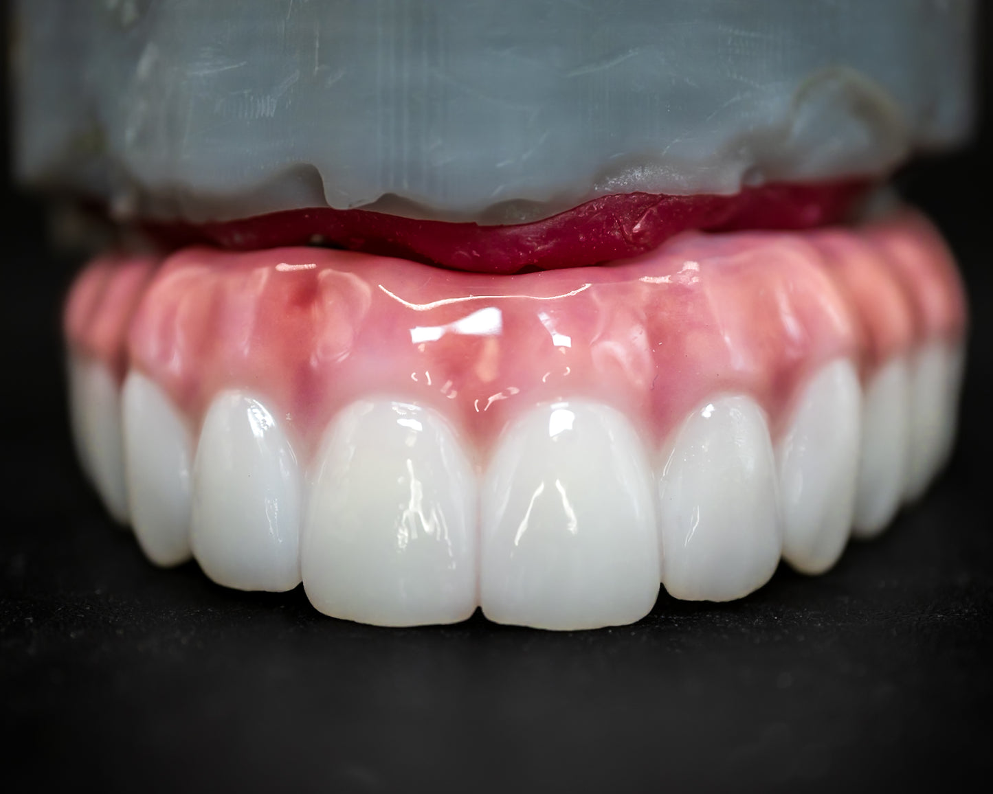 Full Arch Zirconia Hybrid (Additional charges apply)