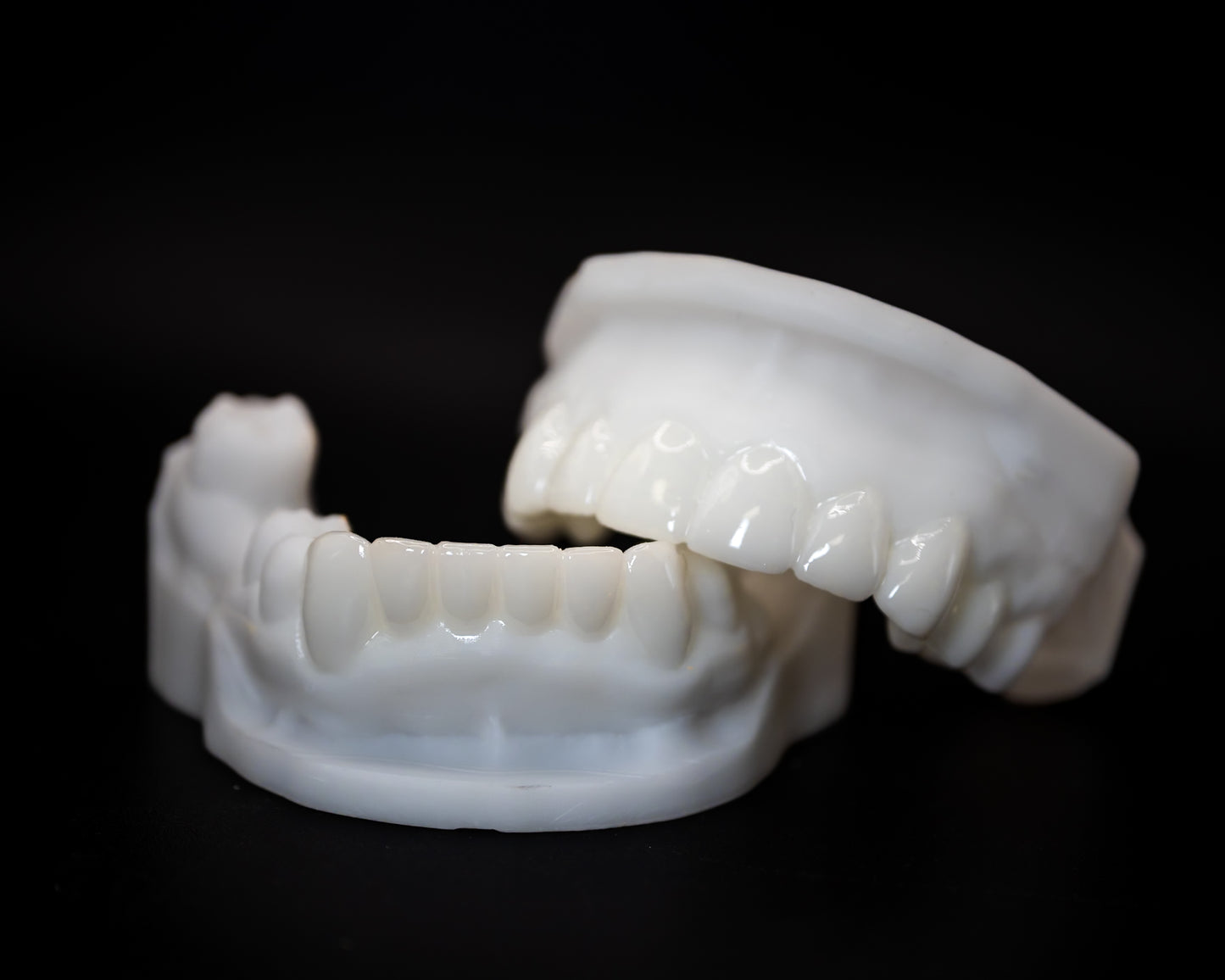 Cosmetic Waxup (Additional charges apply)