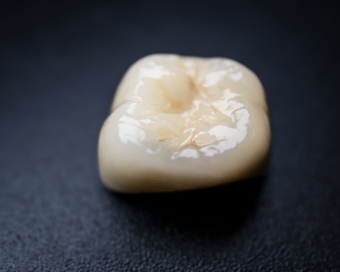 Full Contour Zirconia (Additional charges apply)