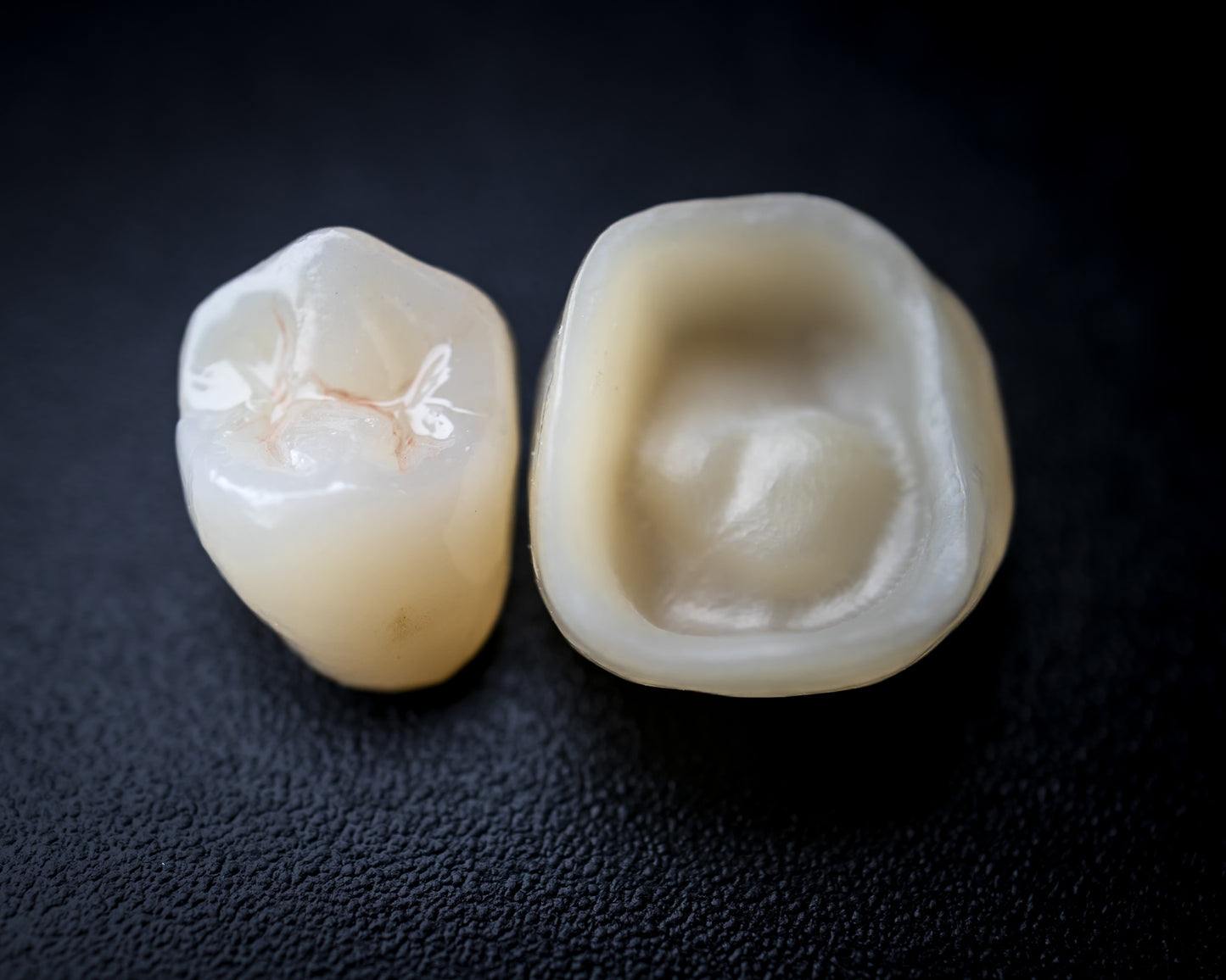 Full Contour Zirconia (Additional charges apply)