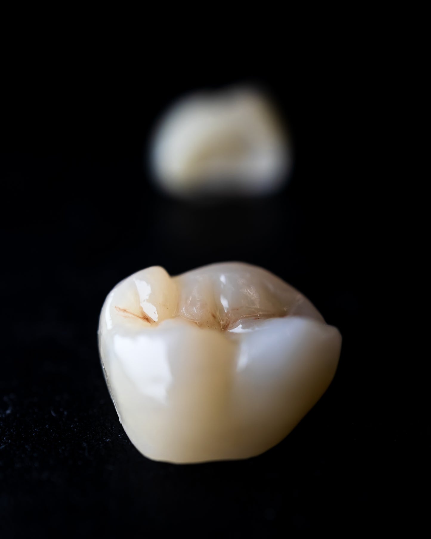 Full Contour Zirconia (Additional charges apply)