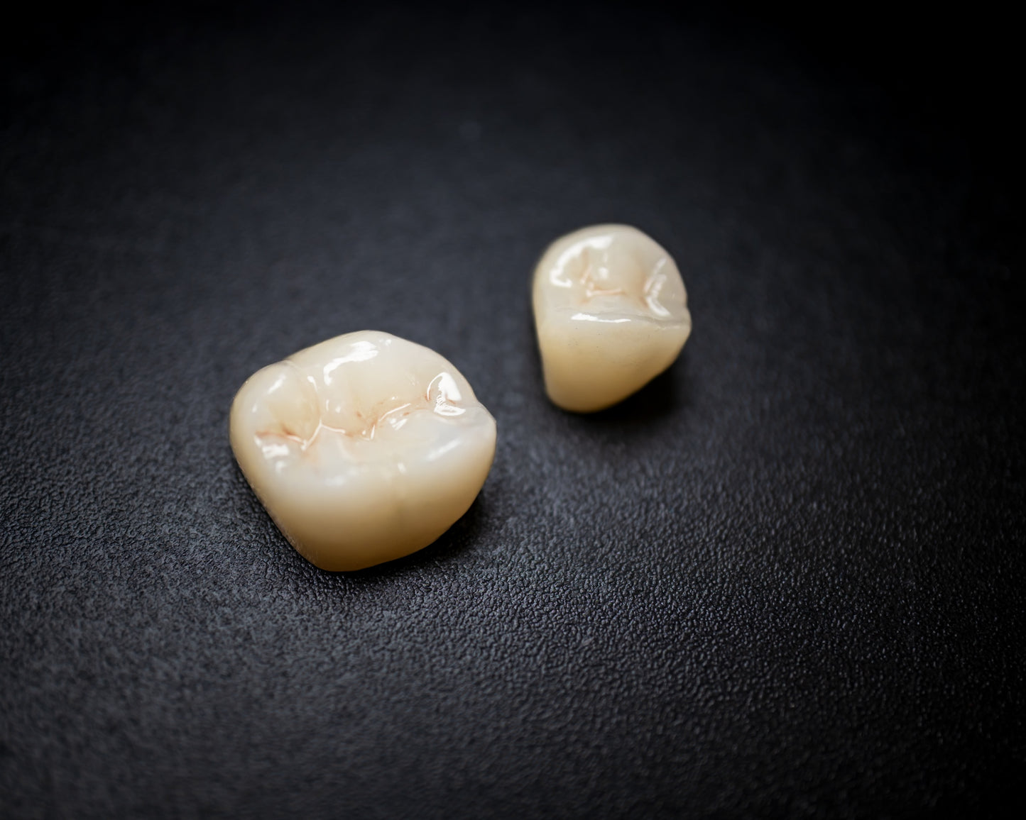 Full Contour Zirconia (Additional charges apply)