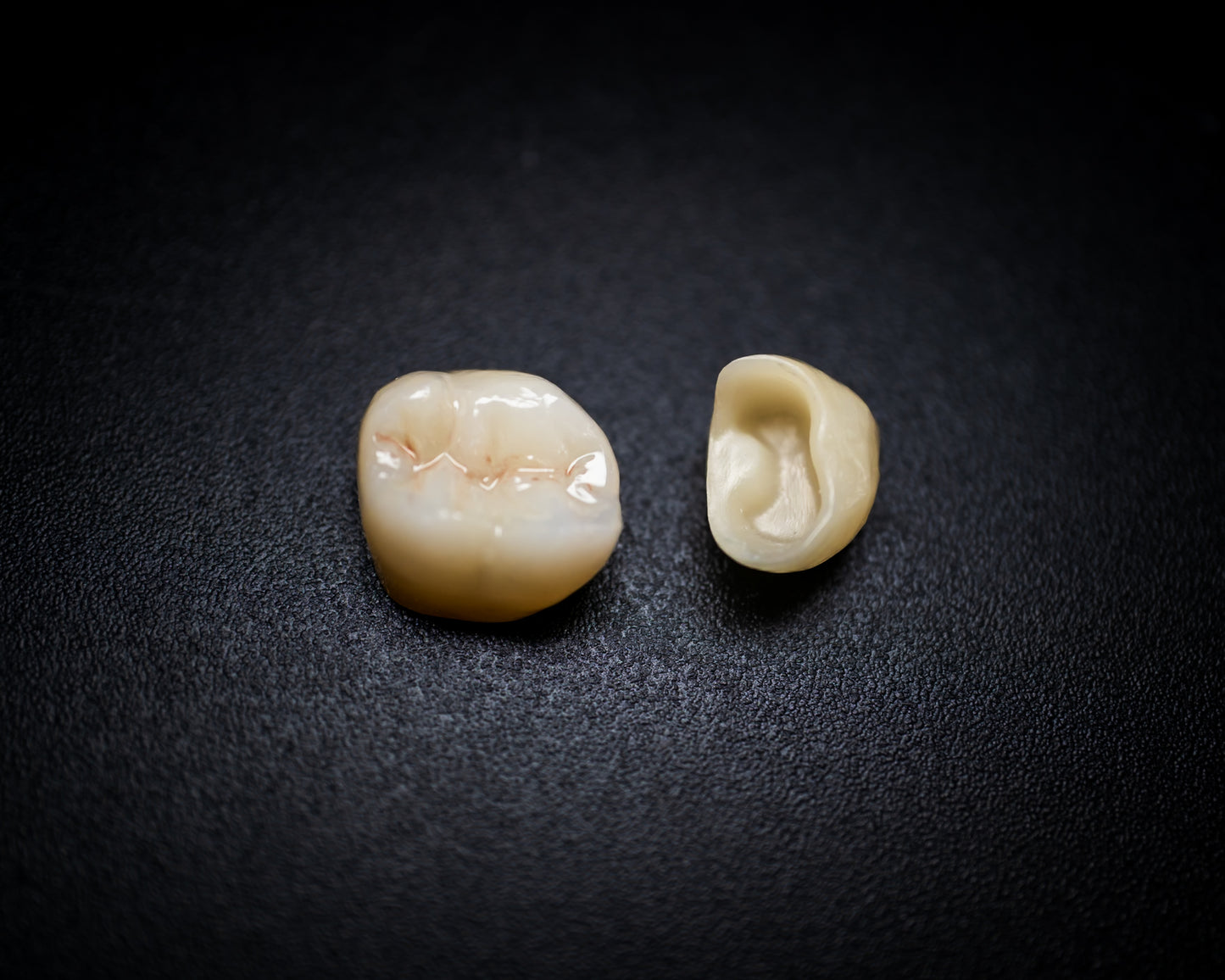 Full Contour Zirconia (Additional charges apply)