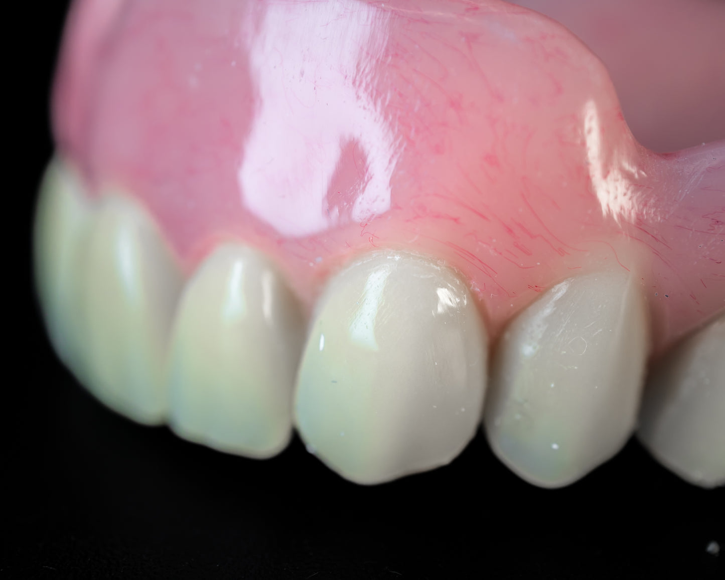 Dentures (Additional charges apply)