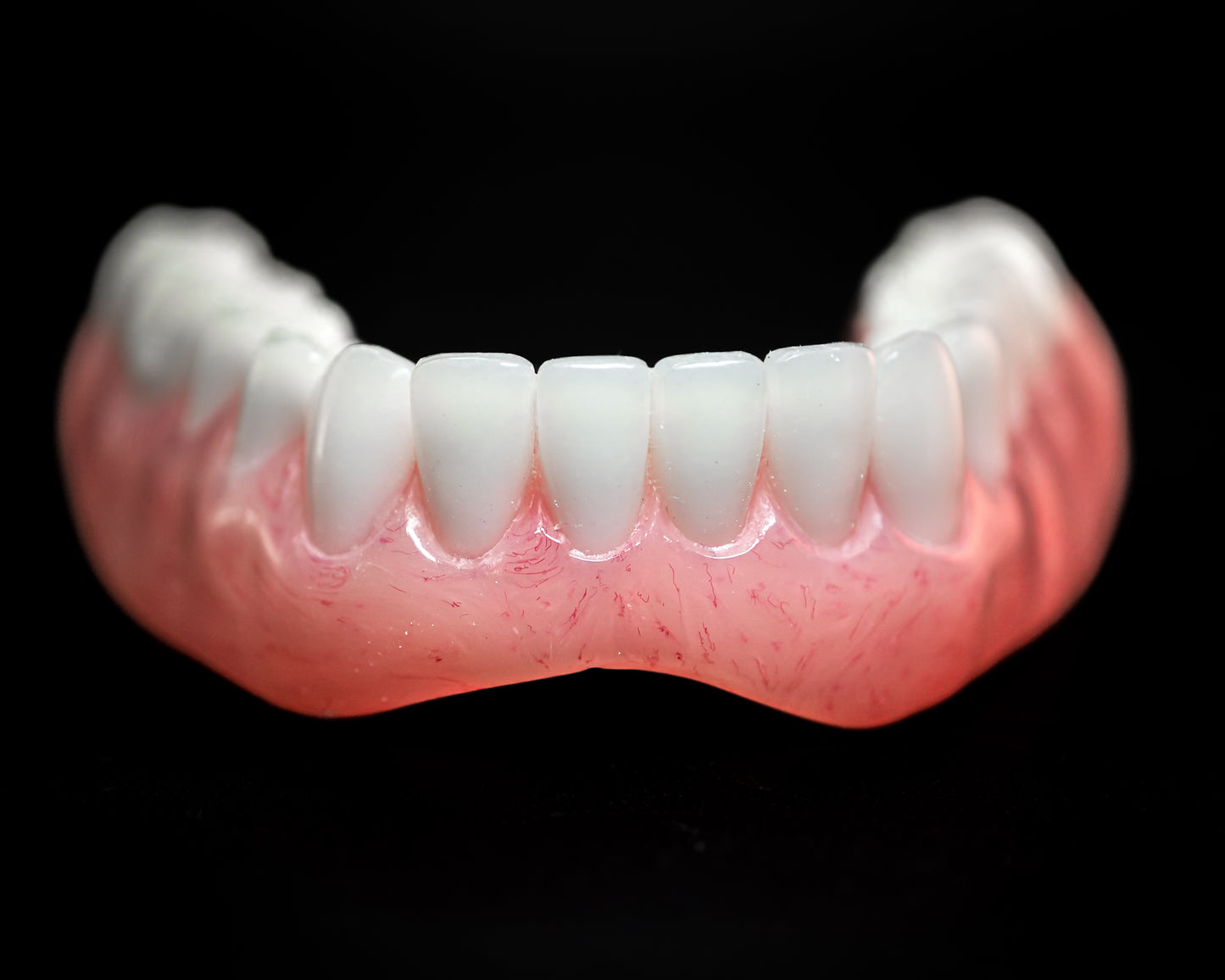 Dentures (Additional charges apply)