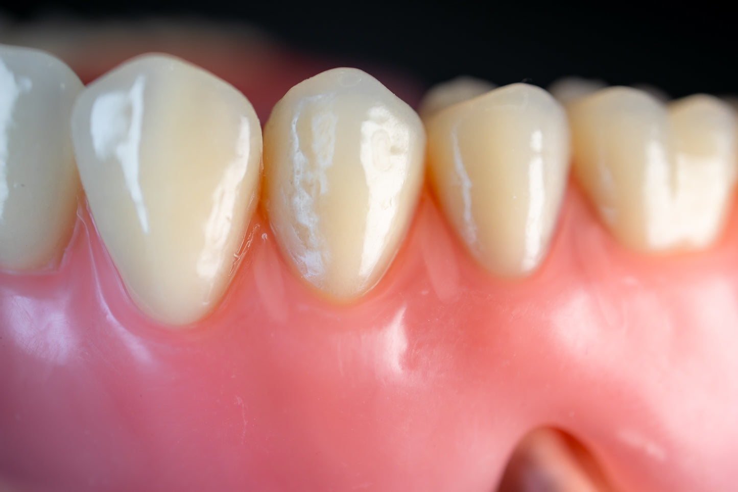 Dentures (Additional charges apply)
