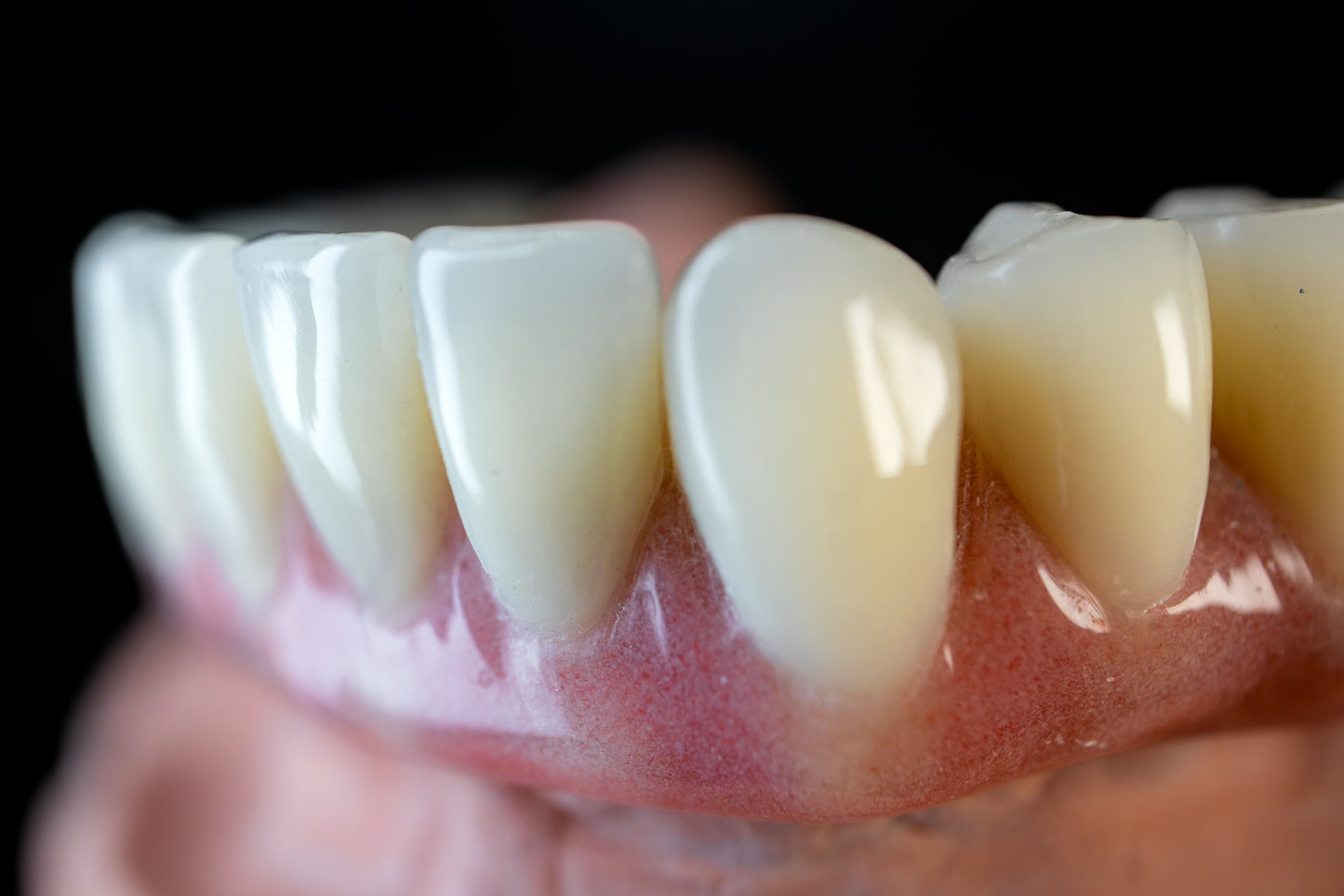 Milled Zirconia