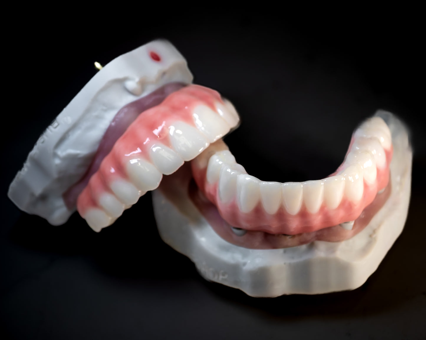 Full Arch Zirconia Hybrid (Additional charges apply)