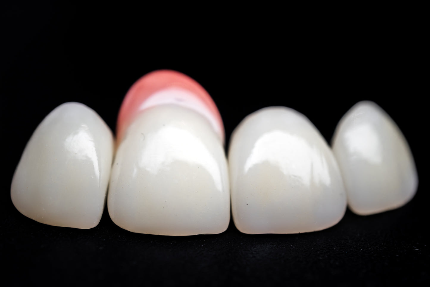 Full Contour Zirconia (Additional charges apply)