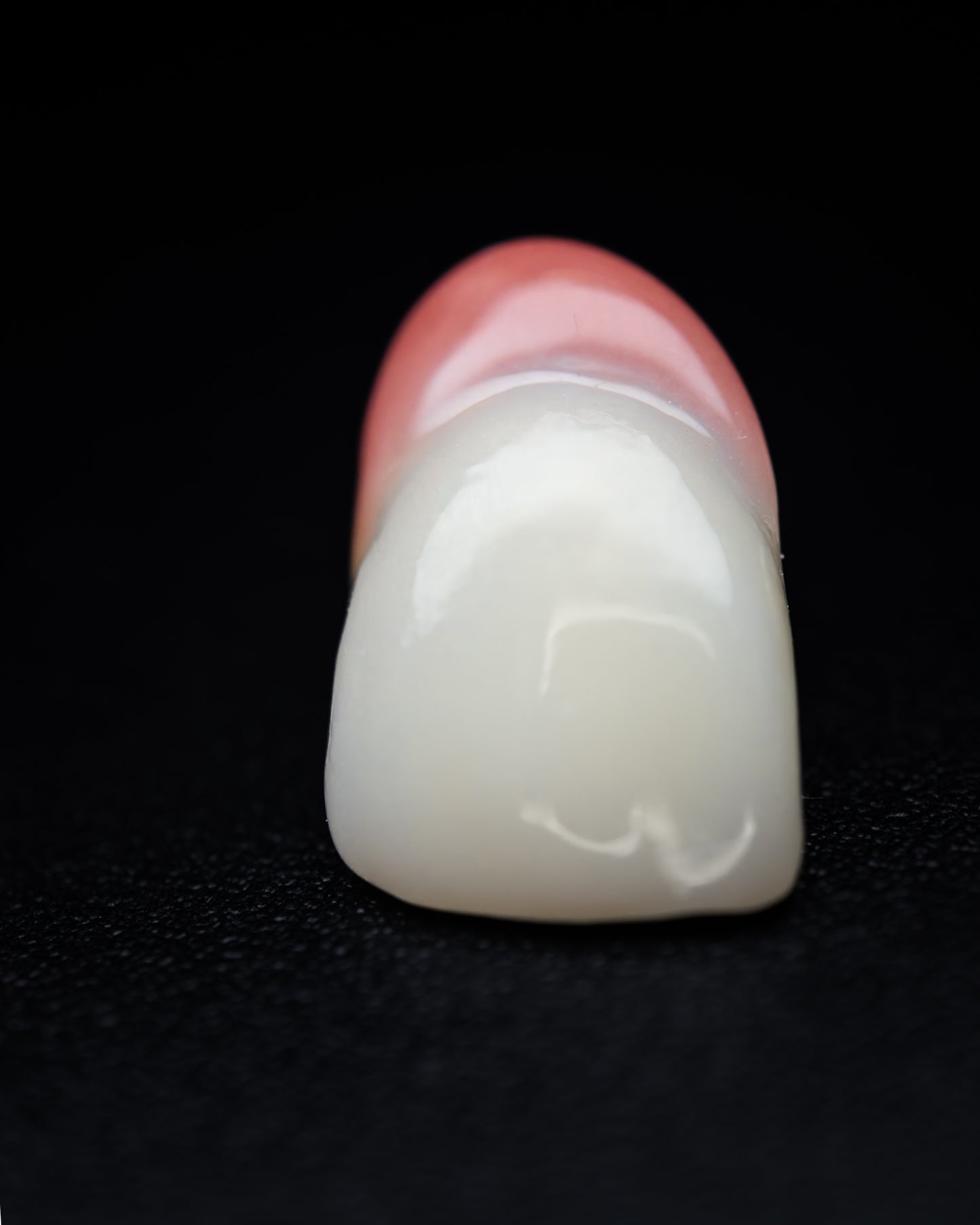 Full Contour Zirconia (Additional charges apply)