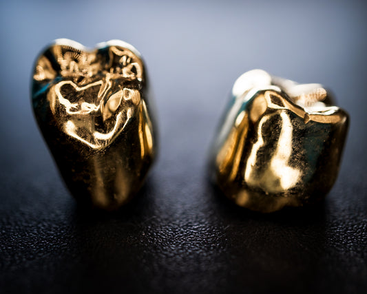 Gold Crown (Additional charges apply)
