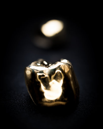 Gold Crown (Additional charges apply)