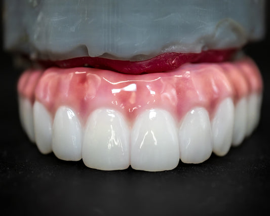 Full Arch Zirconia Hybrid (Additional charges apply)