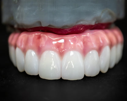 Full Arch Zirconia Hybrid (Additional charges apply)