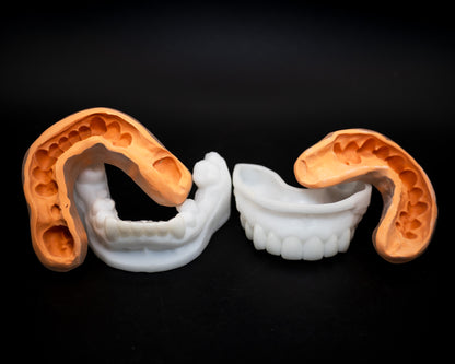 Cosmetic Waxup (Additional charges apply)
