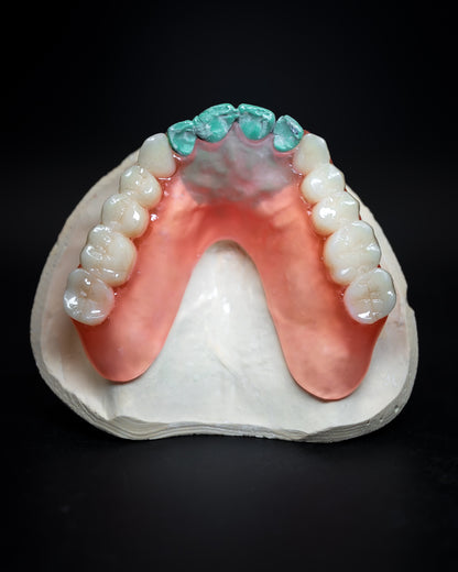 Flexible Partial (Additional charges apply)