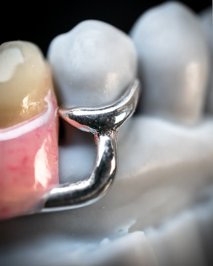 Metal Partials (CoCr) (Additional charges apply)