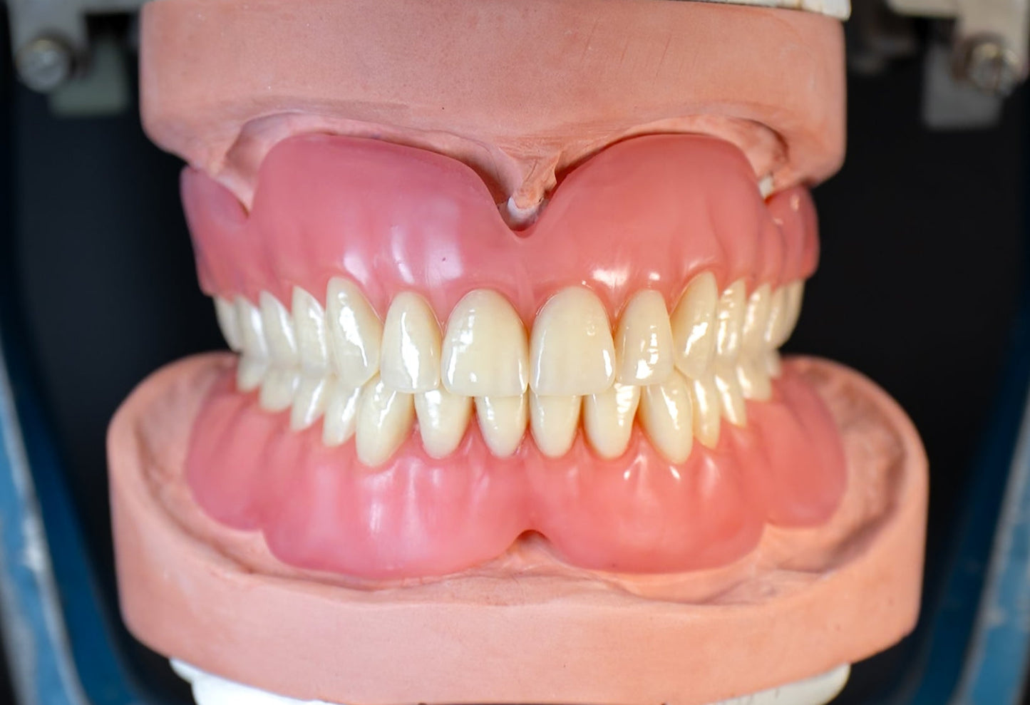 Dentures (Additional charges apply)