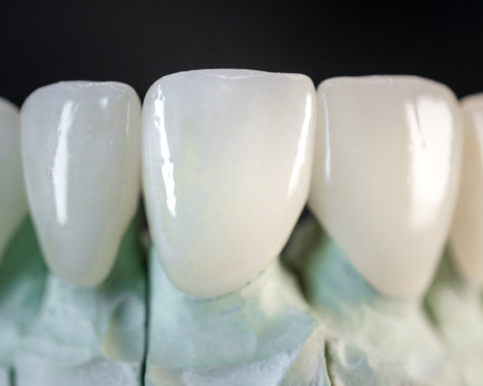 Layered Zirconia (Additional charges apply)
