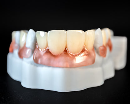 Flexible Partial (Additional charges apply)