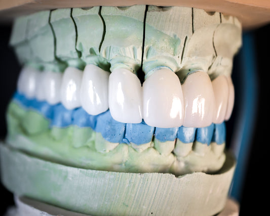 EMAX Crown (Additional charges apply)