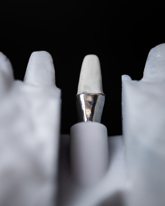 Custom Abutments (Additional charges apply)